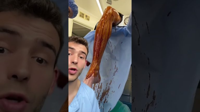 Un aparcacoches agredió a un oficial en una ciudad costera, se volvió viral y se reveló que llevaba 11 años prófugo