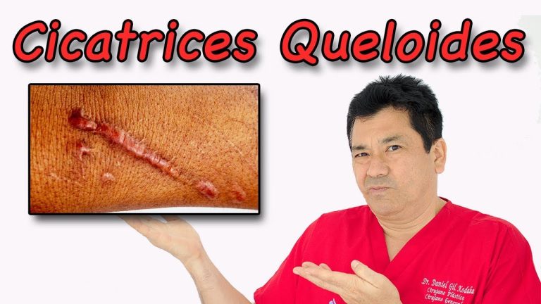 Descubren dos tipos de cicatrices cardíacas y dos métodos para tratarlas