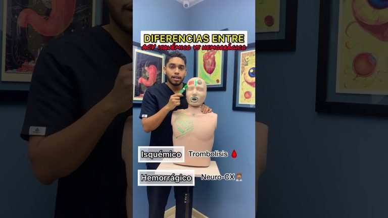 Desarrollan una técnica simple para evaluar el riesgo de ACV en los próximos cinco años