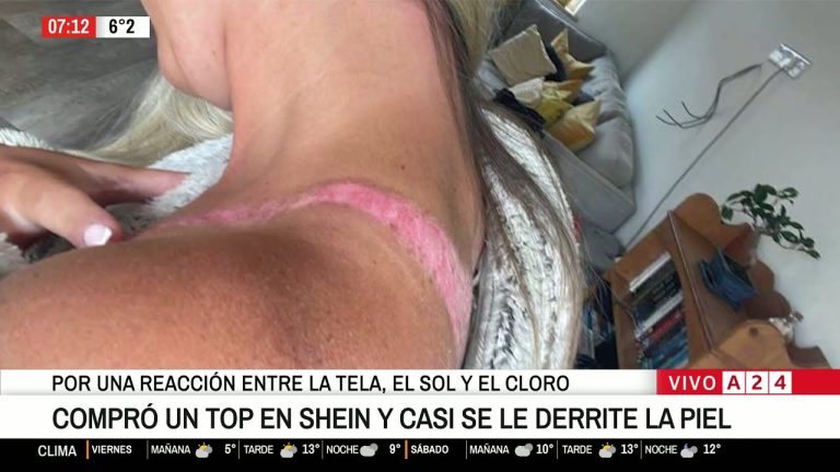 Precauciones con ciertas prendas de Shein y posibles quemaduras en la piel