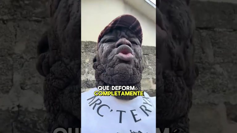 Familia busca evitar que otras vivan su tragedia tras perder a su hijo por una rara enfermedad