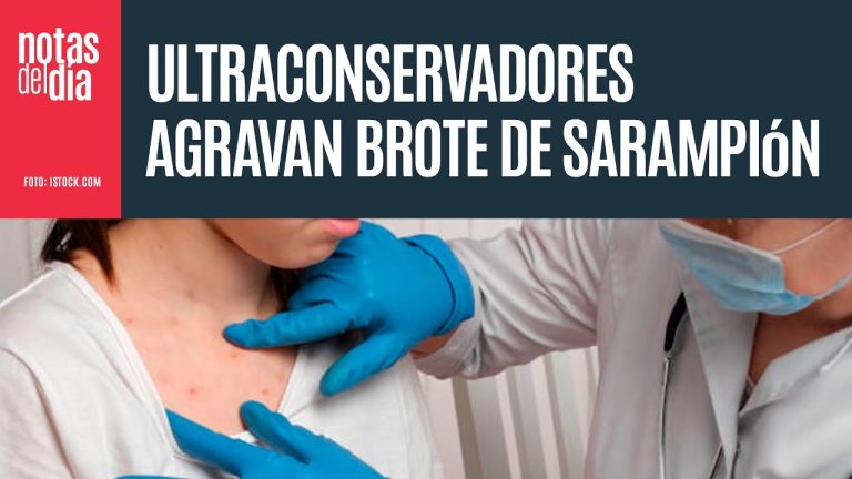 EE.UU. enfrenta el riesgo de perder su estatus de país libre de sarampión, alcanzado hace 25 años