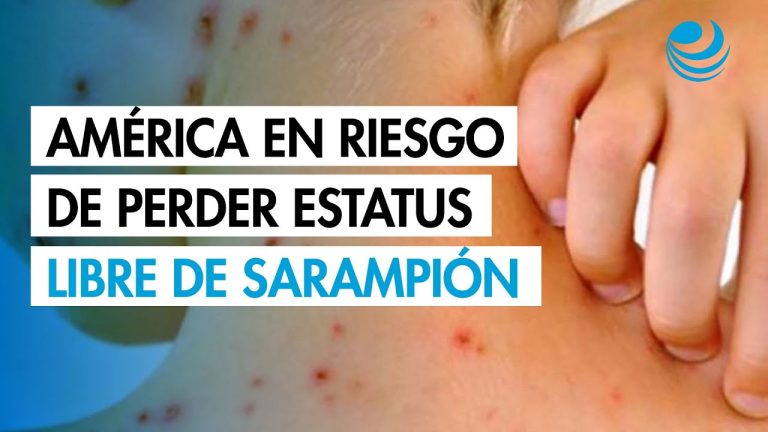 El impacto regional y en Argentina de la pérdida de estatus libre de sarampión en una nación americana