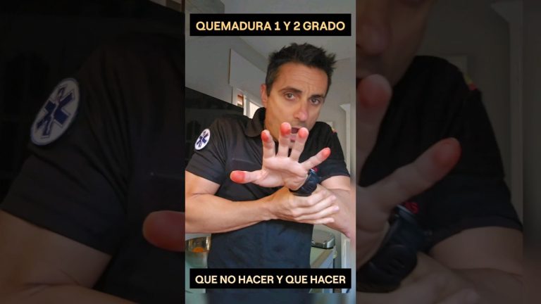 Coche arde y explota en vivienda de Lanús: hombre sufre graves quemaduras