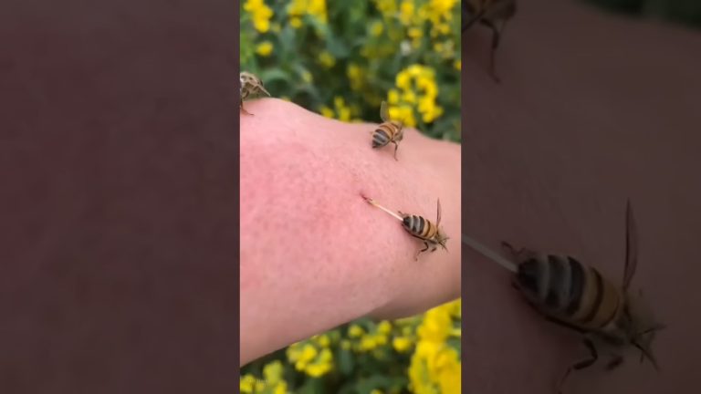 El propietario reciente de Telefe fue internado en Uruguay por picaduras de avispas: “Lleg&oacute; en pre-paro