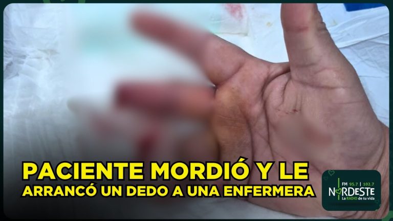 Violento incidente en un centro m&eacute;dico de Chaco: paciente muerde el dedo de una enfermera durante su atenci&oacute;n