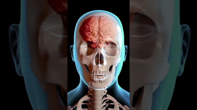 Impactantes lesiones en la cabeza de un menor maltratado antes de su fallecimiento: análisis detallado de los 22 golpes sufridos