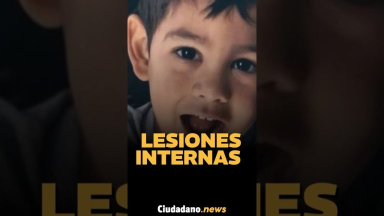 Resultados de la autopsia de Ángel tras su fallecimiento en Comodoro Rivadavia