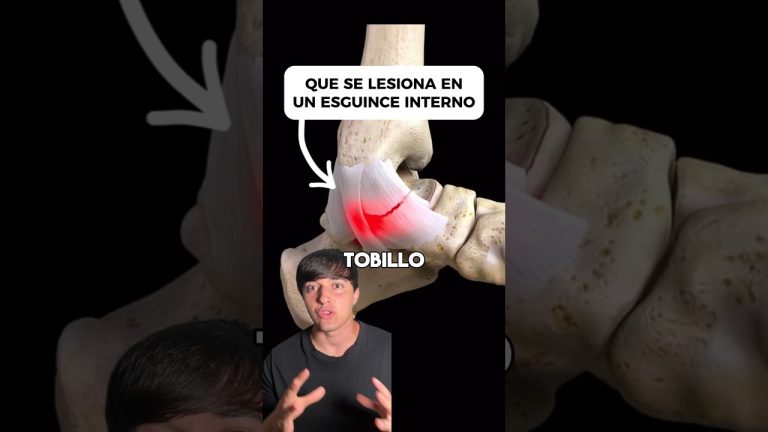 De un esguince a una embolia: descubriendo la cirugía más complicada y el único doctor que la realiza en un hospital público
