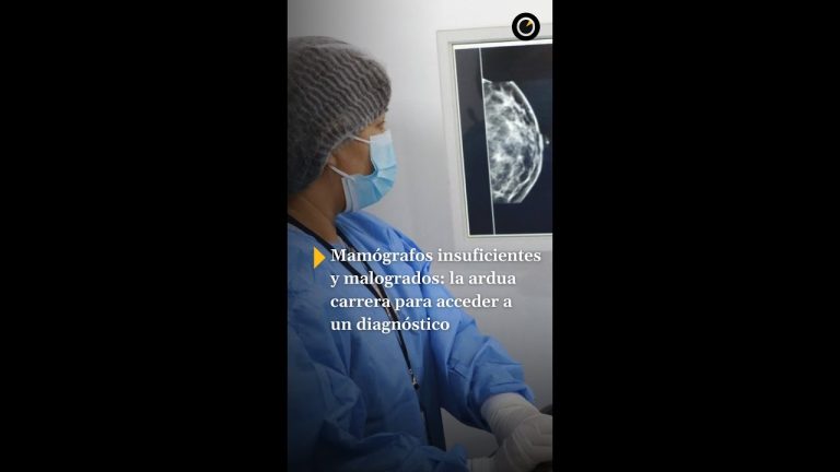 La mayor&iacute;a de los mam&oacute;grafos p&uacute;blicos est&aacute;n concentrados en cinco provincias y presentan un alto &iacute;ndice de fallos