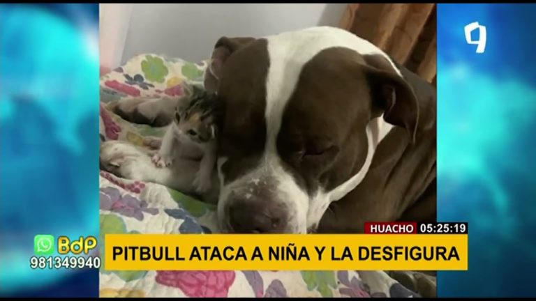 Ataque de pitbull deja a niña de 2 años en cuidados intensivos con serias fracturas faciales