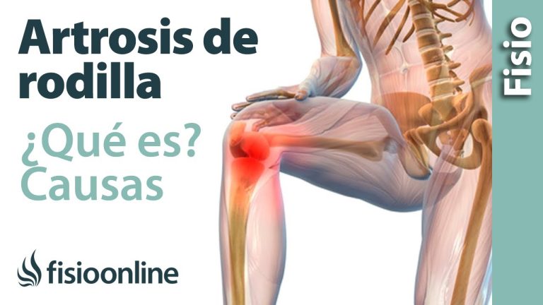 Identifican la causa del dolor de rodillas, un avance en el tratamiento de la artrosis