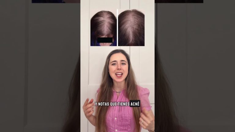 Dermatóloga Leisa Molinari advierte sobre tratar la pérdida de cabello sin información clave.