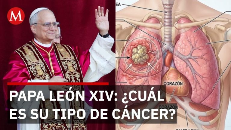 Estado de salud del pontífice: tratamiento necesario para cáncer pulmonar y cómo afecta a su viaje previsto.