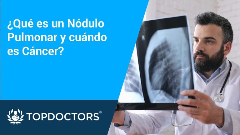 Nódulo en los pulmones: por qué intervendrán quirúrgicamente al pontífice y cuándo es necesario operar